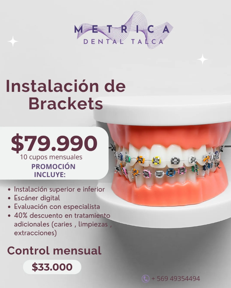 Publicación de Métrica Dental con la promoción de brackets y las condiciones descritas en esta tarjeta